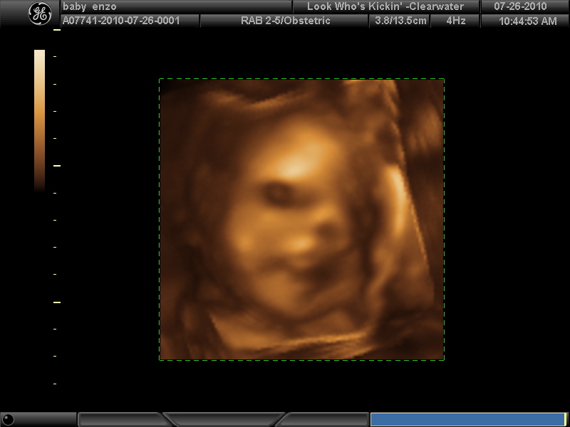 3d ultrasound pictures. 3d Ultrasound 28 Weeks