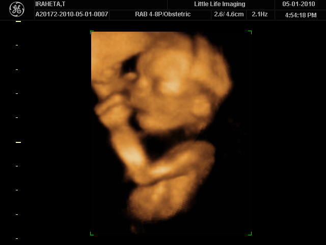 24 Weeks Ultrasound 3d Pocket Bebe
